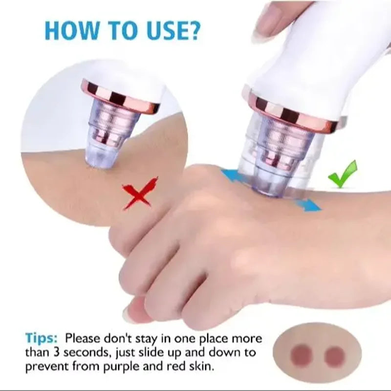 Electric Blackhead Remover & Pore Cleaner
